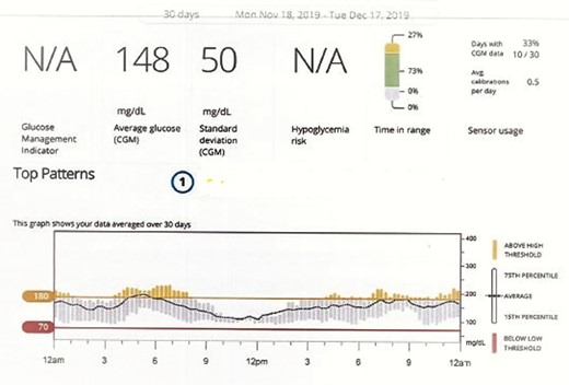 CGM after initiation of semaglutide after 12 weeks. Note the absence of hypoglycemia; mean glucose was 148 mg/dL and HbA1c was 6.7%. There was a further reduction in glycemic oscillations.