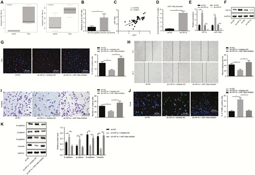 HIF1α promotes the proliferation and migration of PTC cells by increasing the expression of miR-146a. (A) Expression of miR-146a-5p and miR-146a-3p in PTC tissues and normal thyroid tissues based on microarray GSE113629, abscissa indicates sample type. (B) Expression of miR-146a in clinical PTC tissues and adjacent normal tissues (n = 45) determined by RT-qPCR. (C) Correlation between miR-146a and LSD1 determined by Pearson. (D) Enrichment of HIF1α in the promoter region of miR-146a detected by RT-qPCR after ChIP. (E) Expression of HIF1α and miR-146a in K1 cells after transfection with oe-HIF1α determined by RT-qPCR. (F) Expression of HIF1αin K1 cells after transfection with oe-HIF1α determined by Western blot analysis. (G) EdU labeling showing proliferation of K1 cells after inhibition of both HIF1α and miR-146a or either alone (× 200). (H) Scratch test showing migration of K1 cells after inhibition of both HIF1α and miR-146a or either alone. (I) Transwell assay displaying invasion of K1 cells inhibition of both HIF1α and miR-146a or either alone (× 200). (J) TUNEL detection displaying apoptosis of K1 cells after inhibition of both HIF1α and miR-146a or either alone (× 200). (K) Western blot analyses of expression of EMT-related proteins E-cadherin, β-catenin, N-cadherin, and Vimentin in K1 cells after inhibition of both HIF1α and miR-146a or either alone. The data in the figure were all measurement data, which were expressed by the mean ± standard deviation. The data between cancer and adjacent normal tissues in panel B did not conform to the normal distribution and were analyzed using Wilcoxon matched-pairs signed rank test, and unpaired data between 2 groups were analyzed by unpaired t test. Multigroup comparison was conducted using one-way ANOVA. The experiment was independently repeated 3 times. *P < 0.05.