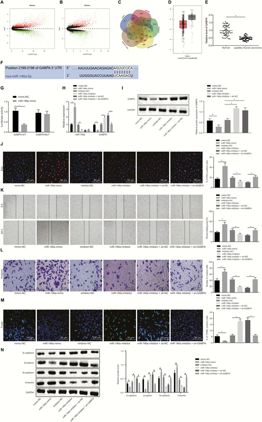 miR-146a targets GABPA to enhance proliferative, migrative, and invasive potentials of PTC cells. (A) The PTC-associated mRNA expression volcano plot of the microarray GSE33630, wherein the black part indicates mRNAs with no significant difference, the green part indicates noticeably downregulated mRNA, and the red part indicates the notably upregulated mRNA. (B) The PTC-associated mRNA expression volcano plot of the microarray GSE3467, the black part indicates mRNAs with no significant difference, the green part indicates noticeably downregulated mRNA, and the red part indicates the notably upregulated mRNA. (C) Intersection of the predicted target genes of miR-146a in the Figure 4 Continued. mirDIP, TargetScan, and miRWalk databases, and downregulated mRNAs in microarrays GSE33630 and GSE3467. (D) GABPA expression in thyroid cancer and normal tissues from GEPIA website. (E) RT-qPCR determination of miR-146a expression in clinical PTC tissues and adjacent normal tissues (n = 45). (F) The binding site of miR-146a to GABPA. (G) The binding relationship between miR-146a and GABPA analyzed by dual-luciferase reporter assay. (H) The expression of GABPA and miR-146a in K1 cells determined by RT-qPCR. (I) The expression of GABPA in K1 cells determined by RT-qPCR and Western blot analysis. (J) EdU-positive cells showing the proliferation of K1 cells (× 200). (K) The migration of K1 cells assessed by scratch test. (L) The invasion of K1 cells evaluated using Transwell assay (× 200). (M) The apoptosis of K1 cells detected by TUNEL (× 200). (N) Expression of EMT-related proteins E-cadherin, β-catenin, N-cadherin and Vimentin measured by Western blot assay. The data in the figure were all measurement data, which were expressed by the mean ± standard deviation. The data between cancer and adjacent normal tissues in panel E did not conform to the normal distribution and were analyzed using Wilcoxon matched-pairs signed rank test, and unpaired data between 2 groups were analyzed by unpaired t test. Multigroup comparison was conducted using one-way ANOVA. The experiment was independently repeated 3 times. *P < 0.05.