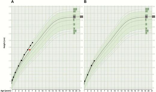 Growth curves of proband’s daughters. The black lines represent growth data of the daughters. The green band represent population reference data (from -2 SDS to +2 SDS). Red dot: bone age at time of measurement. TH: target height. (A) The growth curve of the eldest daughter shows progressive growth acceleration until the age of 4.5 years up to a height of +2 SDS. (B) The curve of the youngest daughter also seems to follow this pattern.