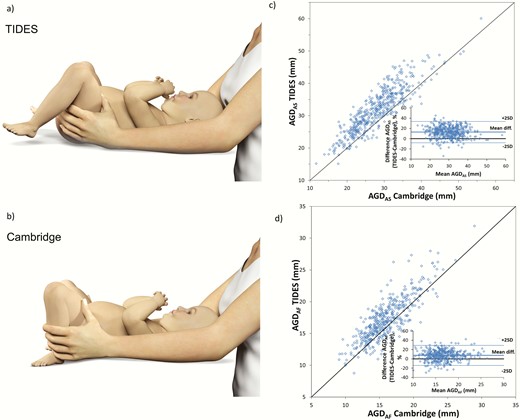 Illustration of child position in TIDES (a) and Cambridge methods (b). TIDES method versus Cambridge method, including Bland-Altman plot for short AGDAS (boys) (c) and short AGDAF (girls) (d). Center 4 only. Dots indicate individual values.
