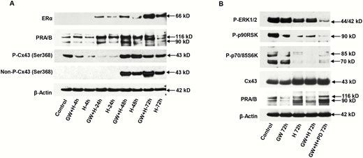 Effects of peroxisome-proliferator-activated receptor β/δ (PPARβ/δ) agonist (GW), hormones (H), and MEK inhibitor (PD) were assessed. A, Time-course and additive effects of GW + H for up to 72 hours were observed for endometrial stromal cell (ESC) expression of estrogen receptor α (ERα) (panel 1), PR-A and -B (panel 2), nonphospho-connexin 43 (Cx43) Ser368 (panel 4), and phospho-Cx43 Ser368 (panel 3). β-Actin levels (panel 5) are shown. Lane 1 represents untreated control cells. B, Relative to controls, a combination of GW, H, and PD for 72 hours led to the lowest phospho-extracellularly regulated kinase (ERK)1/2 (panel 1), phospho-p90 RSK (panel 2), phospho-p70/85 S6Kinase (panel 3) and was associated with the highest levels of total Cx43 (panel 4) and PR-A and -B (panel 5) (P < .05, t-test, n = 3). β-Actin levels (panel 6) are shown as loading controls.