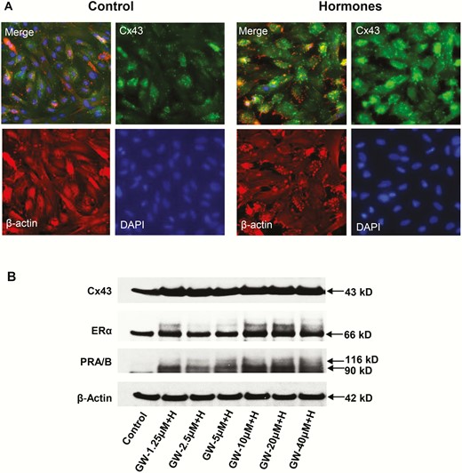 A, The effects of hormone (“H”) treatment on immunofluorescent connexin 43 (Cx43) (green) staining in endometrial stromal cell (ESC) cultures for 72 hours are shown in the upper right panels. A 2.6 ± 0.5-fold increase in Cx43 pixel count (P < .05, t test, n = 4) was noted. DAPI (4’,6-diamidino-2-phenylindole) nuclear staining (lower right panels), β-actin (lower left panels), and a merged frame (upper left panels) also are presented. B, Western blot results in ESCs treated with different concentrations of peroxisome-proliferator-activated receptor β/δ (PPARβ/δ) agonist (GW) combined with decidualizing hormones (“H”) for Cx43, estrogen receptor α (ERα) and PR-A and PR-B are shown. Standard E2 + P4 + 3′,5′–cyclic adenosine 5′-monophosphate (cAMP) hormone concentrations were kept constant while GW levels were increased. ERα (panel 2) and PR-A and -B (panel 3) both revealed dose-dependent increases by the addition of GW (“GW + H”).