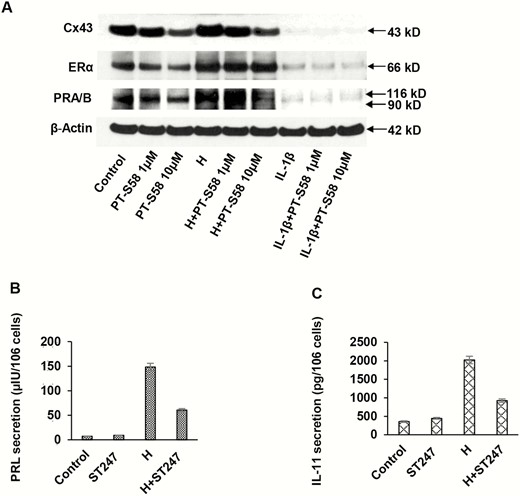 Alternative peroxisome-proliferator-activated receptor β/δ (PPARβ/δ) inhibitors (PT-S58 and ST247) were used to assess effects on endometrial stromal cell (ESC) biomarkers. A, After a 72-hour incubation period, PT-S58 appeared to dose-dependently suppress basal connexin 43 (Cx43) (panel 1) and basal and hormone-induced estrogen receptor α (ERα) and PR (panels 2 and 3). Interleukin 1β (IL-1β) strongly inhibited Cx43, ERα, and PR to such an extent that it is difficult to ascertain whether the PPARβ/δ antagonist caused further inhibition. At the 10-μM concentration, PT-S58 suppressed basal Cx43 to 0.5 ± 0.1-fold and hormone-stimulated Cx43 to 0.3 ± 0.1-fold control levels (P < .05, t test, n = 3). β-Actin levels were not affected (panel 4). The inverse PPARβ/δ agonist, ST247 (10 μM), was incubated with ESCs for 72 hours in the absence or presence of H. Hormone-induced B, prolactin and C, IL-11 secretion were both inhibited more than 50% by ST247, although the inverse agonist had no effect under control conditions (P < .05, t test, n = 3).