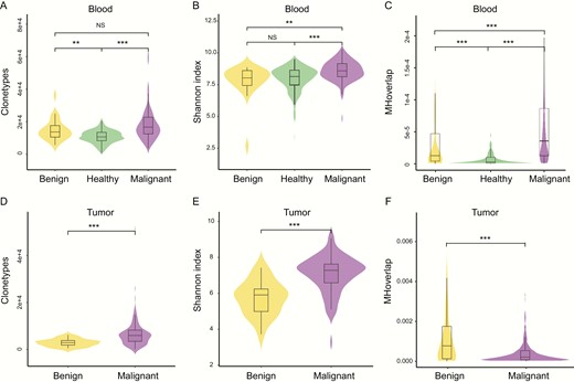 Malignant tumors show more diverse T-cell receptor β (TCRβ) repertoires than benign nodules A, clonotypes, B, Shannon index, C, Morisita-Horn (MH) overlap in blood specimens, D, clonotypes, E, Shannon index, F, MH overlap in tumor tissues. MH overlap index is used to determine similarities of TCR repertoires between samples, *P less than .05; **P less than .01; ***P less than .001.