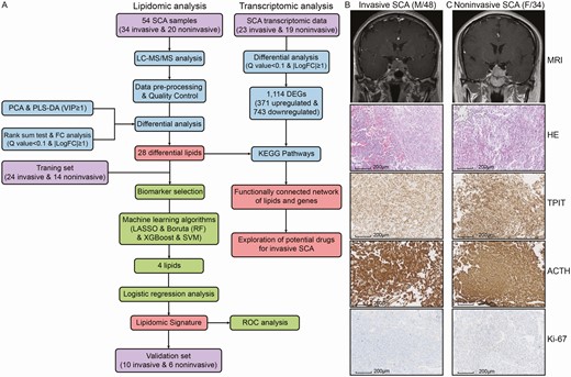 Overall workflow and patient selection for the comprehensive analysis of the lipidomics and transcriptomics of SCAs. (A) Study workflow. Examples of invasive (B) and noninvasive (C) SCAs. Sellar MRI indicated invasive SCAs as Knosp grades III-IV and noninvasive SCAs as Knosp grades I-II. No significant difference between invasive and noninvasive SCAs was observed in the pathologic evaluations, including H&E and IHC staining.