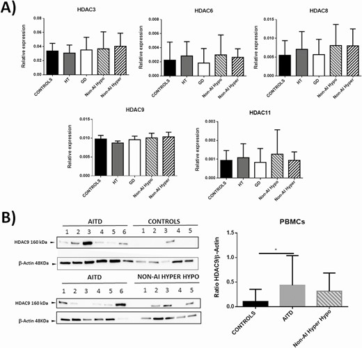 Analysis of expression of HDAC3, 6, 8, 9, and 11 by PBMCs from patients with AITD and controls. A) Blood samples were obtained from healthy controls (n = 13) and patients with HT (n = 12), GD (n = 15), nonautoimmune hypothyroidism (n = 8), or hyperthyroidism (n = 10) and their PBMCs were analyzed by RT-qPCR for the levels of HDAC3, 6, 8, 9, and 11 mRNA. No significant differences were detected among the groups. B) Western blot analysis of HDAC9 expression in PBMCs homogenates from the indicated individuals. A significantly higher amount of HDAC9 was observed in samples from patients with AITD. *P < 0.05.