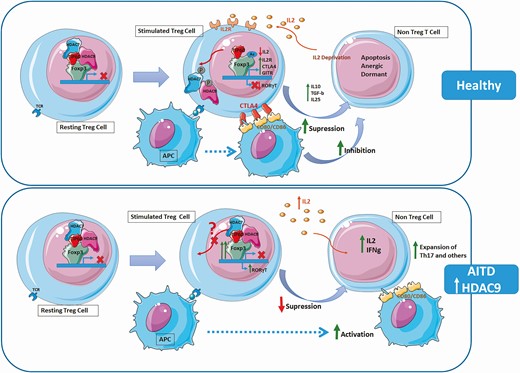 HDAC-mediated regulation of Treg cells. (Upper panel: Healthy condition) In resting Treg cells, FOXP3 recruits the histone acetyl transferase (HAT) TIP60 (in red) and the class IIa histone deacetylase (HDAC) HDAC7 (in blue) and HDAC9 (in pink) inhibiting FOXP3 (in green) transcription. Under TCR stimulation, HDAC7 and HDAC9 phosphorylate and shuttle from the nucleus to the cytoplasm and dissociate from FOXP3. FOXP3 is then acetylated by HATs, such as TIP60, and binds to the promoter regions of target genes such as IL2R (CD25), CTLA4, or GITR. Expression of high IL2R by Treg cells results in IL-2 deprivation of effector cells. CTLA4, downmodulates CD80/CD86 expression by antigen-presenting cells (APCs). The secretion of anti-inflammatory cytokines, such as IL-10, IL-35, and TGF-β and the deprivation of co-stimulatory signal inhibit responder T cells and lead them to apoptosis. (Lower panel: AITD condition) The increased expression of HDAC9 in Tregs may affect its phosphorylation or translocation to the cytoplasm, resulting in a retention of the HDAC complex and supressing Treg activation. APC are activated leading to expansion of Th17 cells and other Teffector cells with an increase in the production of inflammatory cytokines.