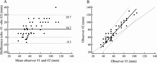 Interobserver analysis of stretched penile measurement. A, Bland-Altman plot: mean (solid line), ±95% limits of agreement (dotted lines), and equality (dashed line) are shown. B, Passing and Bablok regression: mean (solid line), ±95% CI (dotted lines), and equality (dashed line) are shown. Individual measurements are shown as dots.