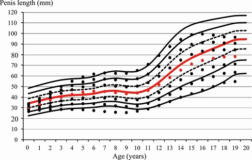 Penis length centiles over age normal-weight boys. Centiles for obese boys are shown as dots. Red line/dot corresponds to 50th percentile.