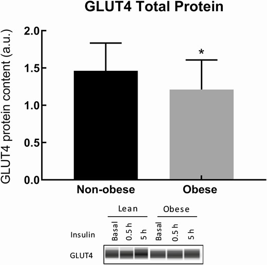 Total GLUT4 protein content of nonobese and obese subjects. Total GLUT4 protein content was measured in muscle biopsy samples. The average of the 3 biopsies was taken per subject. The 17% reduction in GLUT4 total protein in obese compared with nonobese groups is significant (P = 0.047).