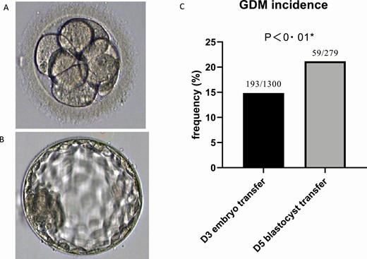 (A) typical human day-3 embryo. (B) Typical human day-5 blastocyst. (C) Bar graphs showing a comparison of gestational diabetes mellitus (GDM) incidence in women receiving just embryos or women receiving at least one blastocyst. *Groups were compared by chi-square test. The morphology and size of the day-3 embryo and the day-5 blastocyst differed substantially indicating a fast development and differentiation during these 2 days of early human life. Blastocyst transfer is an independent GDM risk factor. Yet unknown factors that influence embryo/blastocyst development are potentially also factors that increase the GDM risk later during pregnancy. The blastocyst transferred at day 5 after fertilization might differ substantially from normal blastocysts after natural conception and may later release or stimulate the maternal release of transmitters/hormones promoting GDM development. Abbreviations: D3, day 3; D5, day 5.