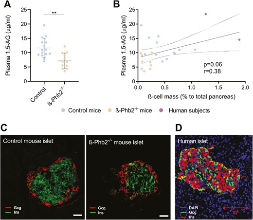 Assessment of the ß-cell mass and plasma concentrations of 1,5-anhydroglucitol (1,5-AG) in mice and humans. (A) Plasma 1,5-AG concentrations of control and ß-Phb2-/- mice of 4 to 6 weeks of age. Values are means ± SD, **P = 0.001 after unpaired t test. (B) Linear correlation between 1,5-AG levels and the ß-cell mass assessed on pancreatic sections by immunohistochemistry and quantified as the percentage of insulin-positive area to total pancreas area in control and ß-Phb2-/- mice (4-6 weeks of age), as well as 2 human subjects with partial pancreas resection (1,5-AG values correspond to the presurgery state); r = Spearman coefficient. (C, D) Representative images of islets on pancreatic sections with immunofluorescence staining for insulin (Ins, green) and glucagon (Gcg, red) for (C) control and ß-Phb2-/- mouse pancreas (scale bar = 20 µm) and (D) a human subject (Ins, red; Gcg, green) with partial pancreas resection (scale bars = 100 µm).