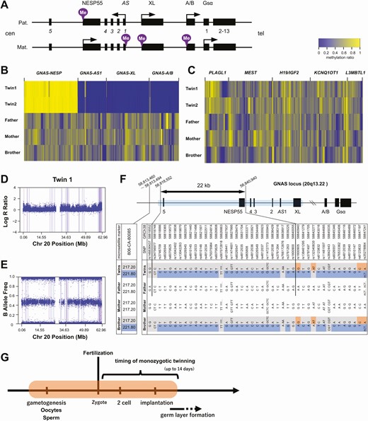 Genetic analyses of the twins and family members. A, Diagram showing the GNAS locus. The methylated allele is indicated by the purple mark at each differentially methylated region (DMR). Arrows indicate transcription start sites and the direction of transcription. B, Heat map visualization of methylation ratio at the GNAS DMRs and C, other representative imprinted loci. The methylation ratio at each CpG site was measured by target bisulfite sequencing. D and E, single nucleotide polymorphism (SNP) array results of twin 1. Plots of D, log R ratio, and E, B allele frequency in chromosome 20 are shown. F, Sanger-sequencing results of the region from AS exon 5 to the XL DMR. The blue box in the schema represents the Sanger-sequenced area. Informative SNPs and fragment length results are listed. The result of fragment analysis of a nearby short tandem repeat (806CA-80085) is also shown. The double arrow indicates the 22-kb region of possible paternal (Pat.) uniparental heterodisomy in the twins. The base positions at both ends are shown, referred to GRCh38. In the table, the blue and the orange boxes indicate paternally and maternally (Mat.) derived alleles, respectively. The gray boxes indicate alleles of undetermined parental origin. G, Schematic representation of the timing of the causative methylation error. The orange-shaded area represents the possible window for the error during development.