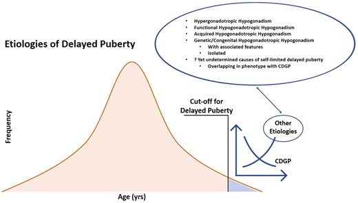 Change in likelihood of different etiologies of delayed puberty by age. For illustrative purposes, the timing of puberty is depicted as a “normal” or Gaussian distribution; however, it is likely that the true distribution is somewhat skewed (17).