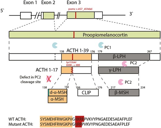 The POMC variant and plausible protein defect. Pro-opiomelanocortin (POMC) is sequentially cleaved to adrenocorticotropin (ACTH) 1-39 by prohormone convertase (PC) 1 and subsequently to ACTH 1-17 by PC2. Carboxypeptidase E (CPE) then processes ACTH 1-17 to desacetyl-α-melanocortin–stimulating hormone (MSH) and α-MSH. The amino acid sequence alignment is shown for wild-type (WT) ACTH and for the mutant ACTH (the amino acid sequence of α-MSH is highlighted in orange, and the PC2 cleavage site in red). PC2 cleaves β-lipotropic hormone (β-LPH) to γ-LPH and β-endorphin. β-LPH is further cleaved to β-MSH (this region is unaffected by the POMC variant).