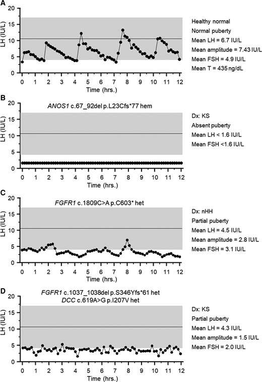 Representative luteinizing hormone (LH) secretion patterns from dynamic LH pulse studies. The 4 panels depict representative LH pulse studies. The shaded region shows the mean ± 2 SDs for health controls (30). A, Healthy adult male with normal puberty. B, Apulsatile LH in a Kallmann syndrome (KS) male harboring a deletion in ANOS1. C, Low-amplitude pulse study in a normosmic hypogonadotropic hypogonadism (nHH) male carrying a rare, pathogenic variant in FGFR1. D, Low-amplitude pulse study in a KS male harboring oligogenic genetic architecture (FGFR1 and DCC).