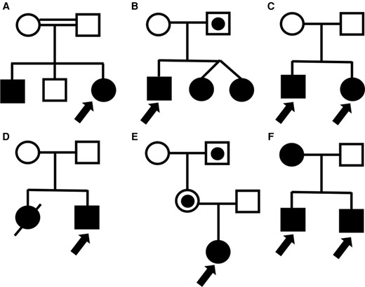 Pedigree for each of the families presented in this paper. (A) Consanguineous family with likely IGHD1A (Case 1). (B) Autosomal dominant disorder causing hypopituitarism with variable penetrance (Case 2). (C) Family with autosomal recessive mitochondrial disorder resulting in SGA children with postnatal growth impairment (Cases 3 and 4). (D) SGA with complex multisystem disorder (Case 5). (E) Silver–Russell syndrome caused by a CDKN1C mutation (Case 6). Only individuals who inherited the mutation on the maternal allele are affected. (F) Familial short stature due to SHOX duplications with autosomal dominant inheritance (Cases 7 and 8).