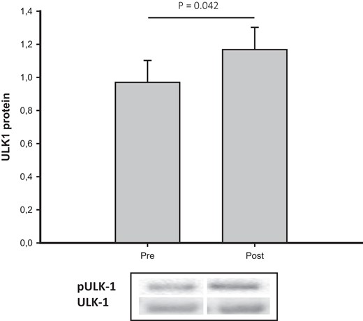 pULK-1/ULK-1 total before (pre) and after (post) disease control in acromegaly. Data are presented as median (CI).Abbreviations: ULK-1, Unc-51 like autophagy activating kinase 1.
