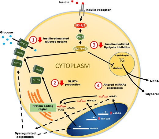 Potential mechanisms leading to adipose tissue dysfunction in polycystic ovary syndrome.