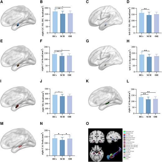 Comparison of hippocampal subfield volume of HCs, SCH, and OH groups. (A) Right GC-ML-DG head subfield. (B) Intergroup differences in right GC-ML-DG head volume among the 3 groups. (C) Left GC-ML-DG head subfield. (D) Intergroup differences in left GC-ML-DG head volume among the 3 groups. (E) Right CA4 head subfield. (F) Intergroup differences in right CA4 head volume among the 3 groups. (G) Left CA4 head subfield. (H) Intergroup differences in left CA4 head volume among the 3 groups. (I) Right ML head subfield. (J) Intergroup differences in right ML head volume among the 3 groups. (K) Right CA3 head subfield. (L) Intergroup differences in right CA3 head volume among the 3 groups. (M) Right CA1 body subfield. (N) Intergroup differences in right CA1 body volume among the 3 groups. (O) Graphical representation of hippocampal subfields segmentation. GC-ML-DG, granule cell molecular layer of the dentate gyrus; ML, molecular layer; HCs, healthy controls; SCH, subclinical hypothyroidism. OH, overt hypothyroidism.