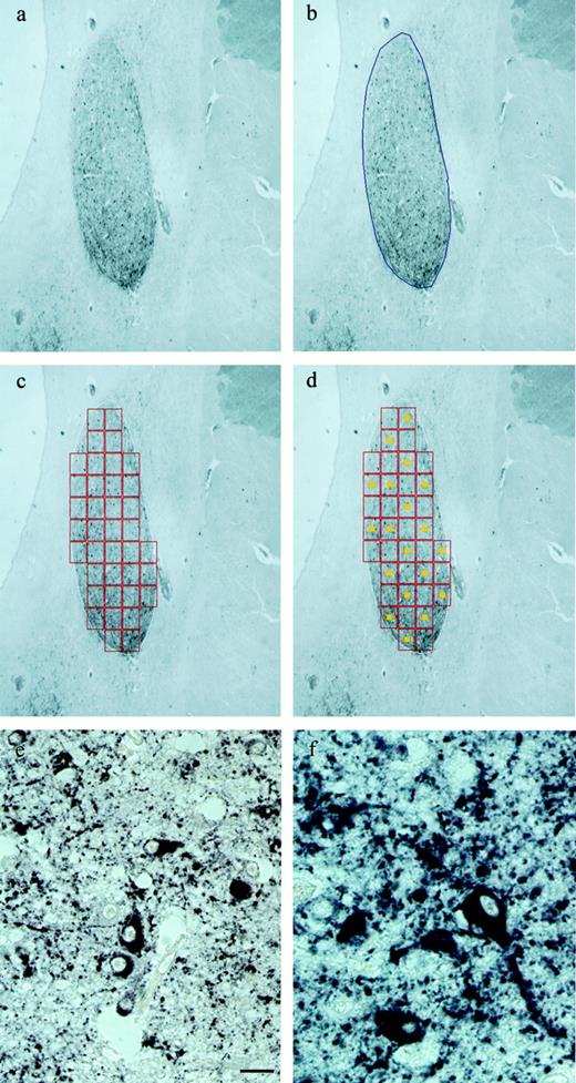 The image analysis procedure. a, Illustration of a somatostatin immunoreactive BSTc. b, The BSTc is outlined manually. c, Outlined BSTc is divided automatically into rectangular fields. d, Fifty percent of the fields is selected by a random systematic sampling procedure. e, Higher magnification of somatostatin neurons in a field displayed by the camera when the ×40 objective is installed. Only somatostatin-positive neurons with a visible nucleolus were counted (see Morphometry in Materials and Methods). Bar represents 40μ m. f, Example of a clearly visible nucleolus in a somatostatin immunoreactive neuron.