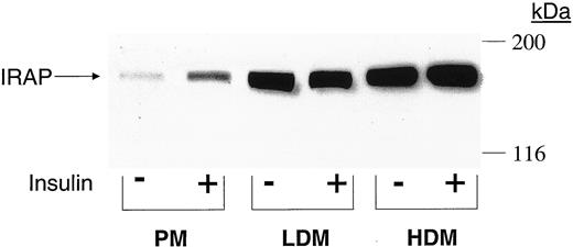 Immunological detection of IRAP in human adipocyte membrane subfractions. Basal and insulin-stimulated adipocytes from a control subject were homogenized and processed to obtain PM, HDM, and LDM subfractions. Equal amounts of membrane protein (100 μg) were resolved by SDS-PAGE, transferred to filters, and reacted with anti-IRAP antibodies, followed by an enhanced chemiluminescence detection system. Migration of molecular weight markers is shown on the right in kilodaltons. The figure is a typical autoradiogram.