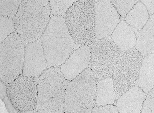 Oil Red O staining of neutral lipid within skeletal muscle at 40× magnification. Lipid droplets are viewed as distinct spots of stain. Images were converted to gray scale for quantification of lipid staining.