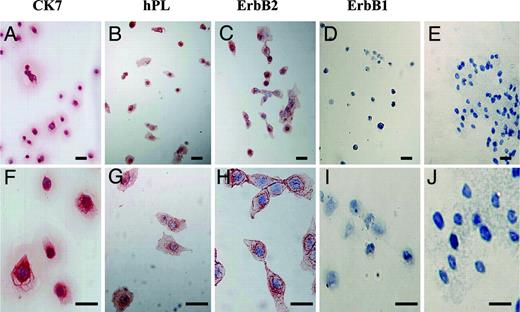 Immunocytochemical staining of CK7, hPL, ErbB2, and ErbB1 in early placental cells attached to FN-precoated dishes after 48-h subculture on FN-precoated dishes. Immunocytochemical analysis of the cells after 48-h subculture demonstrated that CK7 (A and F), hPL (B and G), and ErbB2 (C and H) were present, whereas ErbB1 was absent (D and I). Replacement of the primary antibody with nonimmune murine or goat IgG resulted in a lack of positive immunostaining in the cells after 48-h subcultures (E and J). Bars, 50 μm. Original magnification: A–E, ×200; F-J, ×400.