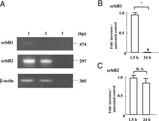 The mRNA expression of erbB1, erbB2 in early placental cells attached to FN-precoated dishes after 1.5- and 24-h subcultures, as assessed by quantitative RT-PCR. First strand cDNA was synthesized from total RNA extracted from cultured early placental EVTs after 1.5- and 24-h subcultures. Each 0.1 μg cDNA was subjected to RT-PCR as described in Materials and Methods. The 474-bp PCR product specific for erbB1, the 297-bp PCR product specific for erbB2, and the 305-bp PCR product specific for β-actin were detected. The amounts of erbB1 and erbB2 mRNA were expressed relative to the abundance of β-actin mRNA. Data were presented as the fold increases over the average intensity of β-actin mRNA. RT-PCR analyses of mRNA extracts from the cells after 1.5- and 24-h subcultures revealed that 474-bp erbB1 mRNA was present after 1.5-h subculture, but was undetectable after 24-h subculture (A), whereas 297-bp erbB2 mRNA was abundantly present not only after 1.5-h subculture, but also after 24 h-subculture (A). The 474-bp mRNA expression of erbB1 after 24-h subculture significantly decreased compared with that after 1.5-h subculture (P < 0.05; B), whereas the mRNA expression of 297-bp erbB2 after 24-h subculture was comparable with that after 1.5-h subculture (C). Experiments were repeated four times with similar results for each. Lane 1, 1.5-h subculture; lane 2, 24-h subculture; lane 3, negative control. Each value is expressed as the mean ± sd. *, P < 0.05. n.s., Not significant.