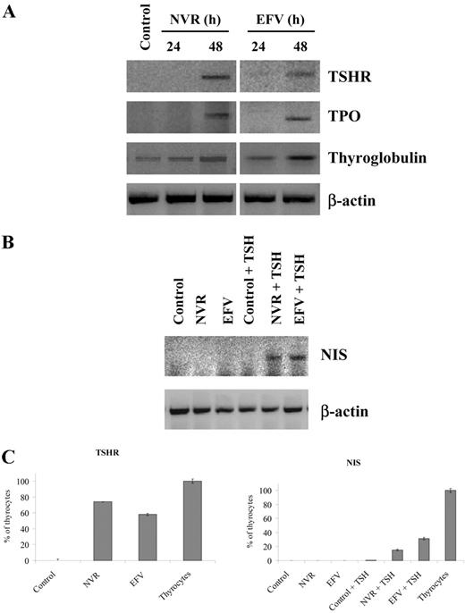 RT inhibitors up-regulate TSH receptor and NIS gene expression and restore TSH signaling in anaplastic thyroid carcinoma ARO cells. A, Total RNA was extracted from ARO cells incubated for 24 and 48 h in the presence and absence of 350 μm nevirapine (NVR) or 10 μm efavirenz (EFV) and amplified by semiquantitative RT-PCR, using primers specific for TSH receptor (TSHR), thyroglobulin, and TPO genes. β-Actin was used as internal standard. B, ARO cells were incubated for 96 h in the presence and absence of 350 μm NVR or 10 μm EFV and then stimulated with 2 mU/ml human rTSH in the presence of either drug. Total RNA was amplified by semiquantitative RT-PCR using primers specific for the NIS gene. C, Total RNA was extracted either from ARO cells, exposed to 350 mm NVR or 10 μm EFV in the presence and absence of rTSH, or from normal thyrocytes and amplified by real time RT-PCR, using primers specific for the TSHR and NIS genes. GAPDH was used as internal standard. Gene expression was expressed as a percentage of that observed in normal thyrocytes.