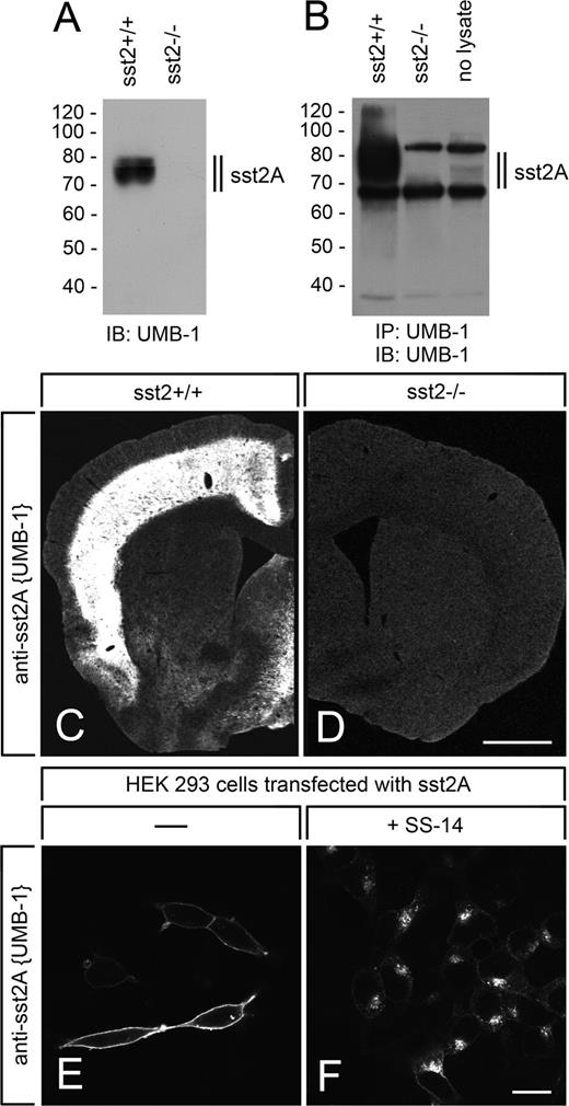Reassessment of sst2 Somatostatin Receptor Expression in Human Normal ...