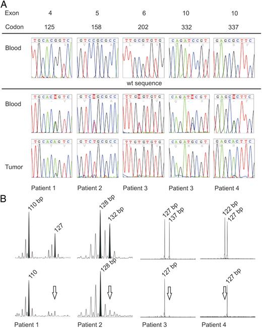 A、 生殖系TP53突变序列和肿瘤组织中的相关序列（中央和底部）。野生型外显子的相同序列如参考（顶部）所示。B、 患者1和2，TP53内含子4中微卫星区域VNTR4的分析。患者3和4，TP53内含子1中微卫星区域VNTR1的分析。上排，种系LOH分析，未显示等位基因缺失。下排，LOH分析肿瘤组织，每个病例中都有一个等位基因缺失。bp，碱基对。