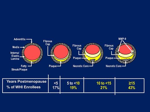 Progression of coronary atherosclerosis by age in postmenopausal women and the ages of women participating in the hormonal trial of the WHI. [Adapted from T. B. Clarkson: The new conundrum: do estrogens have any cardiovascular benefits? Int J Fertil Womens Med. 2002;47:61–68 (7), with permission. © U.S. International Foundation for Studies in Reproduction, Inc.]