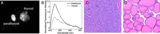 Healthy parathyroid and thyroid fluorescence in canine subjects.
