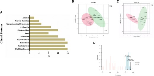 (A) The clinical spectrum of patients with PHO. (B) PLS-DA scores plot, (C) OPLS-DA scores plot, (D) and cumulative values of patients with PHO (N = 16) vs HCs (N = 16).