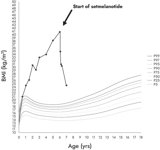Evolution of the patient's BMI before and after initiation of setmelanotide. The different curves represent the BMI percentile curves from the 5th percentile (P5) to the 99th percentile (P99).