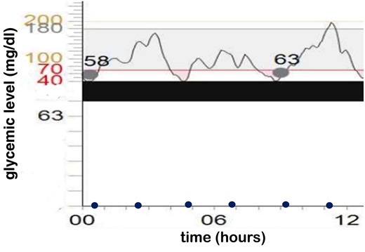 Glycemic levels. The x-axis represents the hour; the y-axis represents blood glucose levels. Time of the meals are displayed with blue dots. Dots crossing the graphic are the calibration of the continuous glucose monitoring system.