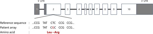 Structure of the MEN1 gene and the variant in this case. White boxes indicate exons, horizontal bars indicate introns, gray boxes represent untranslated regions (UTRs). In this case, a missense variant was found in exon 2 (c.266T > G; p.Leu89Arg). *The figure was drawn with reference to reference 4.