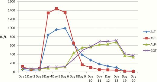 Trends in liver function tests during admission following high-concentration insulin glargine overdose up to day 20. An early rise in alanine aminotransferase (ALA) and aspartate aminotransferase (AST) was noted from day 3, closely matching the rise in bilirubin. A delayed rise in alkaline phosphatase (ALP) and gamnma-glutamyl transferase (GGT) was noted from day 6. No blood tests were taken on day 8.