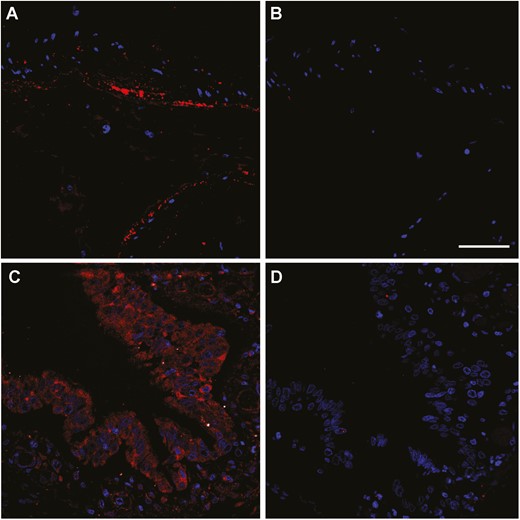 Representative confocal microscopy images of lung tissue sections from non-COVID-19 autopsy specimens. Figure shows RAMP1 immunoreactivity (red) in the smooth muscle cells of an artery (A and B) and in the bronchiolar epithelium (C and D). Absence of the primary antibody (B and D) was used as a negative control. Cell nuclei were counterstained with DAPI (blue). Scale bar = 50 µm.