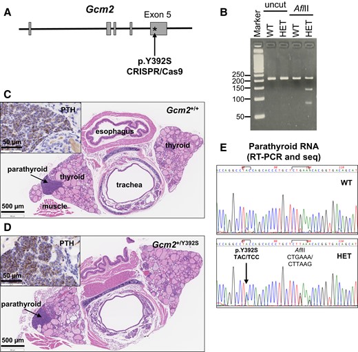 Knock-in mouse model of the Gcm2 variant p.Y392S. (A) Strategy for variant knock-in. CRISPR/Cas9 gene editing technology was used to generate mice with the missense variant p.Y392S (TAC > TCC) within exon 5 of the mouse Gcm2 gene (Ensembl Transcript: ENSMUST00000021791). (B) Agarose gel images of representative mouse genotyping analysis. PCR amplification of tail DNA from Gcm2+/+ (WT) and Gcm2+/Y392S (HET) mice was performed using primers flanking the region where the p.Y392S variant and the downstream AflII site was introduced. Uncut and AflII digested PCR products were analyzed by agarose gel electrophoresis. The PCR product of WT mice shows a band at 210 bp in both uncut and AflII cut lanes. The PCR product of HET mice shows the 210 bp WT band and 2 bands at 130 and 80 bp generated by the AflII digest. (C and D) Brightfield microscopy images of tracheal region tissue sections to detect parathyroid glands. FFPE tissue sections of tracheal blocks of Gcm2+/+ (C) and Gcm2+/Y392S (D) mice were processed for hematoxylin and eosin (H&E) staining to locate parathyroid glands. Inset shows parathyroid hormone (PTH) staining by anti-PTH immunohistochemistry of the parathyroid glands in a serial section. (E) Gcm2 expression in parathyroid gland RNA. Expression of WT Gcm2 and p.Y392S variant was assessed in parathyroid gland RNA by RT-PCR and PCR product sequencing. Compared to WT, the Gcm2 nucleotide sequence of Gcm2+/Y392S (HET) shows the presence of the heterozygous p.Y392S variant and the downstream AflII restriction enzyme site.