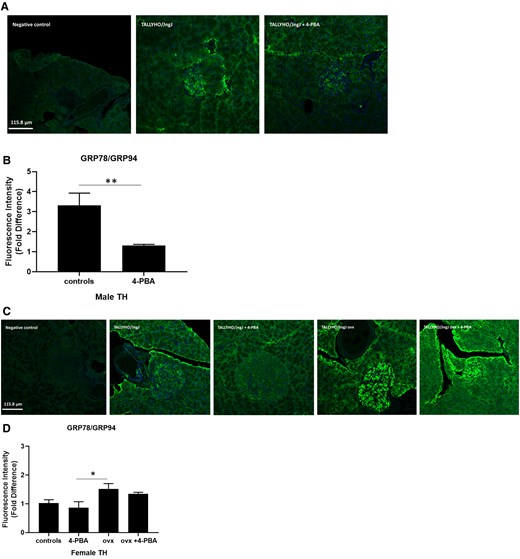 Expression of adaptive UPR markers GRP78/GRP94 in pancreatic islet sections of (A, B) male and (C, D) female sham, female ovariectomized (ovx) TALLYHO/JngJ mice either treated or not with 4-PBA. n = 4 to 5 per group. *P < .05, **P < .01. Bars represent standard error of the mean (SEM).
