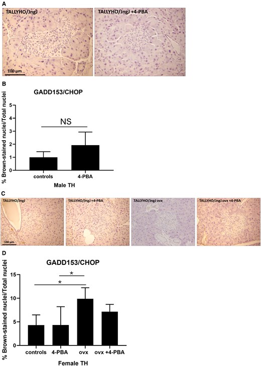 Expression of apoptotic UPR marker GADD153/CHOP in pancreatic islet sections of (A, B) male, (C, D) female sham or ovariectomized TALLYHO/JngJ mice either treated or not with 4-PBA. n = 4 to 5 per group. *P < .05. Bars represent standard error of the mean (SEM).