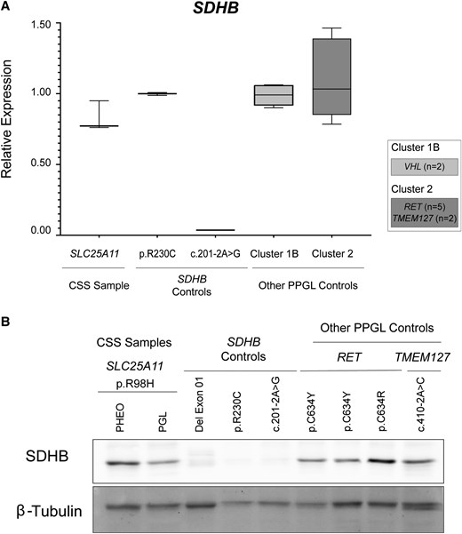 (A) Analysis of SDHB transcript levels in PPGL tumor samples using RT-qPCR. Bars represent the mean ± SD between replicates. CSS sample (patient sample): Refers to the RNA obtained from the paraganglioma (PGL) and pheochromocytoma (PHEO) of a patient with Carney-Stratakis syndrome harboring the novel heterozygous germline variant c.293G>A (p.R98H) in SLC25A11. SDHB Controls: Includes tumor samples from patients carrying pathogenic SDHB variants, specifically p.R230C (c.688C>T) and c.201-2A>G (near the canonical splice site). Other PPGL samples: Includes tumor samples from patients harboring pathogenic variants in Cluster 1B (VHL, n = 2) and Cluster 2 (RET, n = 5; TMEM127, n = 2). The ACTB gene was used as an endogenous control. (B) Western blot analysis of total SDHB protein levels in PPGL tumor samples, including both PHEO and PGL samples from the patient with CSS. Three SDHB-deficient tumor samples were used as controls. The specific gene variant for each sample is indicated in the figure. β-Tubulin protein was used as a loading control.