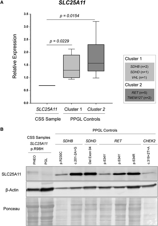 (A) Reduced mRNA levels of SLC25A11 in tumor samples from the patient with Carney-Stratakis syndrome (CSS). Bars represent the mean ± SD from replicates. CSS sample (patient sample): Refers to the RNA obtained from the paraganglioma (PGL) of the CSS patient. Other samples: Includes pheochromocytoma (PHEO) and PGL from patients harboring pathogenic variants in Cluster 1 (SDHB, n = 2; SDHD, n = 1; VHL, n = 1) and Cluster 2 (RET, n = 5; TMEM127, n = 2). The ACTB gene was used as an endogenous control. (B) Western blot analysis of SLC25A11 protein levels in PHEO and PGL samples from the CSS patient. The gene variant for each sample is indicated in the figure. β-Actin was used as a loading control, and protein loading was further verified by Ponceau S staining.