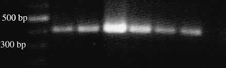 PCR product of the 5S rDNA repeat unit of H. distortus. First lane on the left, DNA molecular marker (100 bp ladder); consecutive lanes, PCR product of different individuals.