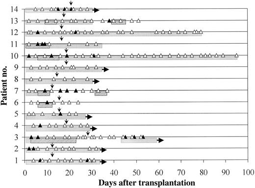 Polymerase chain reaction (PCR) results for patients with a history of invasive aspergillosis (IA) before transplantation (proven in patients 1–3, possible in patients 4–8, and probable in patients 9–14). One patient developed progressive IA during the study period (patient 3, figure 2). Patients 2 and 9 developed IA at days 156 and 90, respectively, after transplantation. Patients 5 and 10 died from relapse, patient 7 from acute graft-versus-host disease, patients 11 and 13 from regimen-related toxicity, and patient 12 from cytomegalovirus-induced interstitial pneumonia. ▲, Positive PCR result; △, negative PCR result; narrow arrows, date laminar air flow was stopped; hatched bars, intravenous amphotericin B; and shaded bars, itraconazole.
