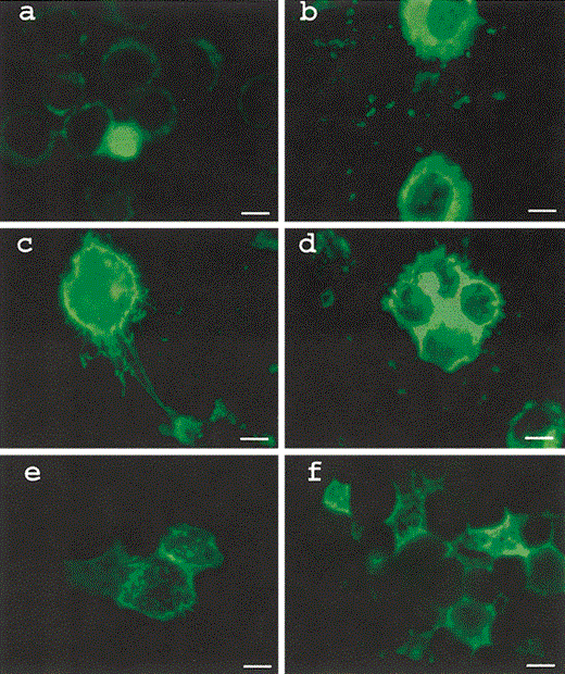 U937 cells infected with respiratory syncytial virus (RSV) in the absence (a, c and e) and presence (b, d and f) of enhancing antibody (serum from a monkey immunized with formalin-inactivated RSV at a dilution of 1:10) and stained with polyclonal RSV goat antibody tagged to fluorescein isothiocyanate after 24 (a and b) 48 (c and d) and 72 (e and f) h. Bar 10 μm