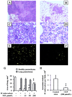 Morphological examination of lung tissue in Mycobacterium tuberculosis-infected mice (A, C, and E) and in M. tuberculosis-infected sphingosine 1-phosphate (S1P)-treated mice (B, D, and F). In particular, almost all the lung parenchyma was occupied by granulomas in M. tuberculosis-infected mice (A, magnification 200×), which were characterized by a necrotic core, a polymorphous in.ammatory infiltrate (C, magnification 800×) and disseminated auramine-stained mycobacteria (E, magnification 2000×). Treatment with S1P induced a dose-dependent reduction of lung granulomas (B, magnification 200×) that was characterized by a prevalent macrophage infiltrate without a significant necrotic reaction (D, magnification 800×) and a smaller no. of auramine-stained mycobacteria (F, magnification 2000×). G, Summary of the areas of healthy lung parenchyma (empty column) and of granulomas (dashed column), expressed as mean ± SD, evaluated by analyzing 10 fields covering the entire lobe surface from 4 mice/experimental group. H, Summary of the mean ± SD of the no. of auramine-stained bacilli observed on 20 granulomas/experimental group. °P = NS, *P = .02, and **P < .0001, vs. M. tuberculosis-infected S1P-untreated mice.